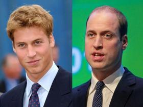 男生脱发饮食注意事项