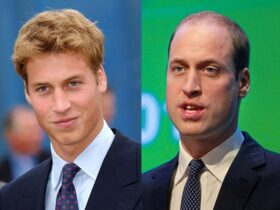 男生脱发饮食注意事项